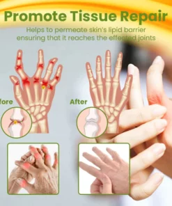 LIMETOW™ BEETox Joint & Bone Therapy Cream