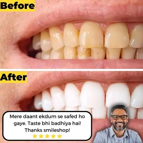 LIMETOW™ Color-correcting Purple Mousse Toothpaste