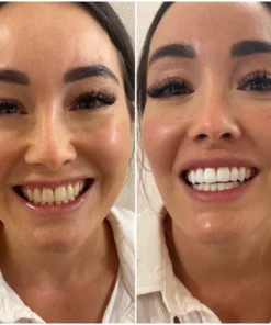 LIMETOW™ Color-correcting Purple Mousse Toothpaste