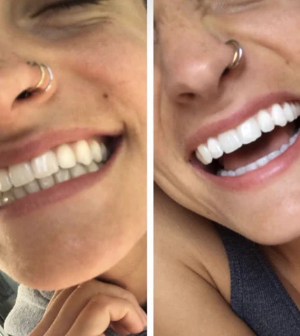 LIMETOW™ Color-correcting Purple Mousse Toothpaste