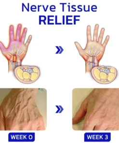 LIMETOW™ NumbFix Hands and Foots Spray