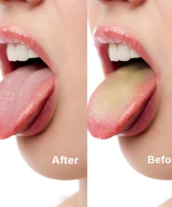 LIMETOW™ Tongue Cleaner