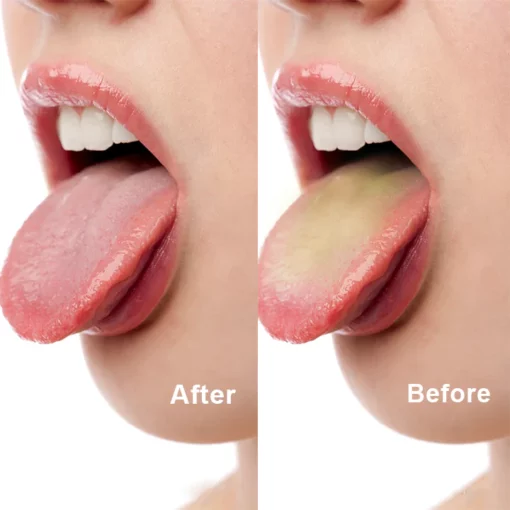 LIMETOW™ Tongue Cleaner