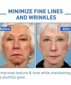 LIMETOW™Face Serum