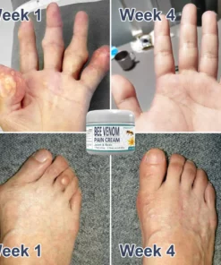 LOVILDS™ Bee Venom Pain and Bone Healing Cream