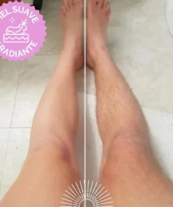 Laserdam™ Painless Laser Hair Removal Machine