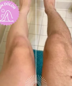 Laserdam™ Painless Laser Hair Removal Machine