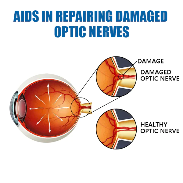 Ourlyard™ Eye drops for treating vision issues