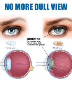 Ourlyard™ Eye drops for treating vision issues