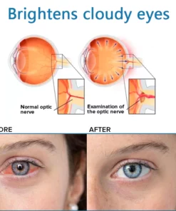 Ourlyard™ Eye drops for treating vision issues