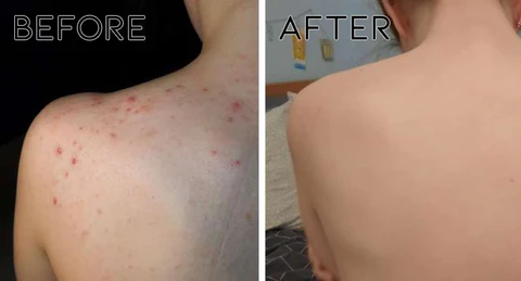 Oveallgo™ visokofrekventna ultrazvučna narukvica koja odbija bube