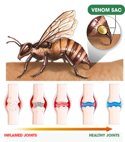 Oveallgo™ Bee Venom Joint & Bone Pain Healing Cream