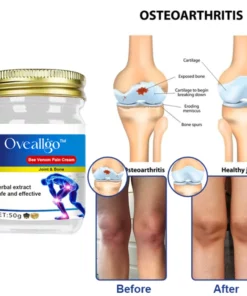 Oveallgo™ Bee Venom Joint & Bone Pain Healing Cream