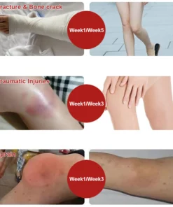 Oveallgo™ Bee Venom Joint & Bone Pain Healing Cream