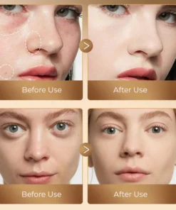 Oveallgo™ Instant Cover Three-color Concealer