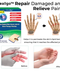 Oveallgo™ New Zealand Bee Venom Joint & Bone Therapy Patches