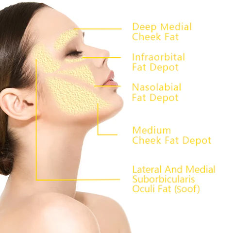 Oveallgo™ UltraRenew Ultrasonic Facelift Device
