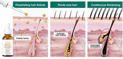 Porevival™ Suero natural para el crecimiento del cabello