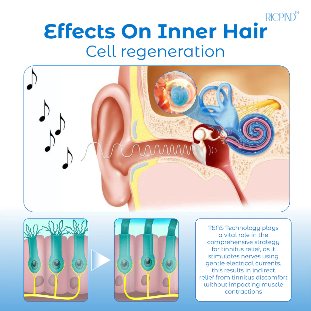 RICPIND Tinnitus NerveTreat Infrared Thermal Pen