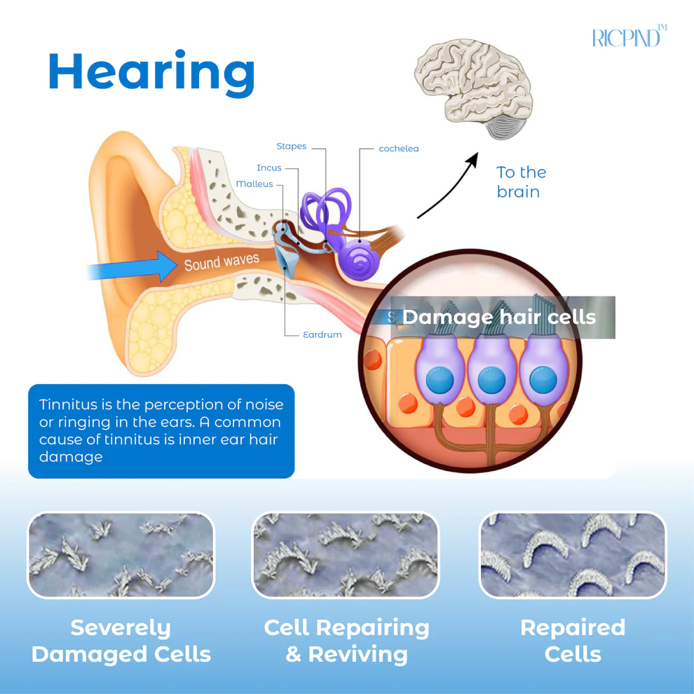 RICPIND Tinnitus NerveTreat Infrared Thermal Pen
