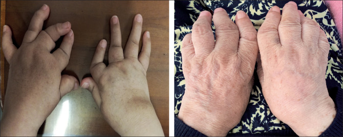 RICPIND Titanium Ionized Far Infrared Therapy ArthritisRelief Gloves 