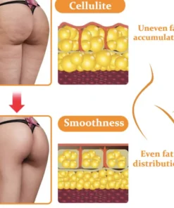 Fivfivgo™ EMS Gesäßstraffungsmassagegerät