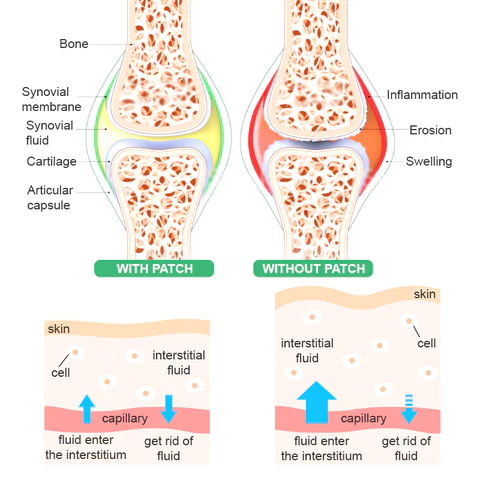 StrongJoints Anti Knee Pain Patch
