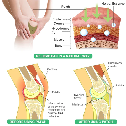 StrongJoints Anti Knee Pain Patch