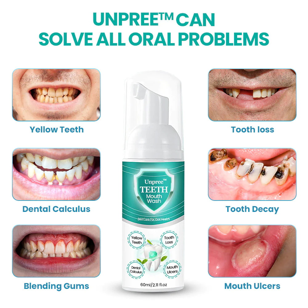 UNPREE™ TEETH Mouthwash - Solve all Oral Problems