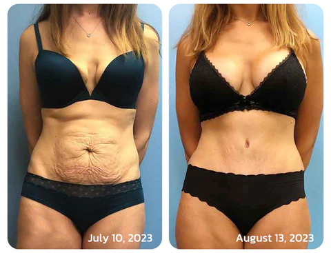flysmus™ DoublePeach Collagen Sapun za punjenje
