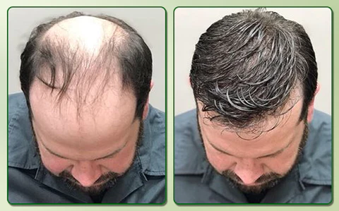 Biancat™ LuxtroPro Rosmarin ätherisches Öl