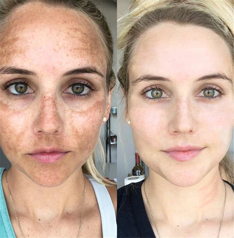 Ceoerty™ LumiSkin Exfoliating Facial Scrub 