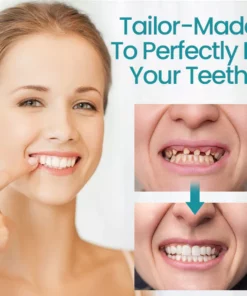 Ceoerty™ Adjustable Buckle Dentures