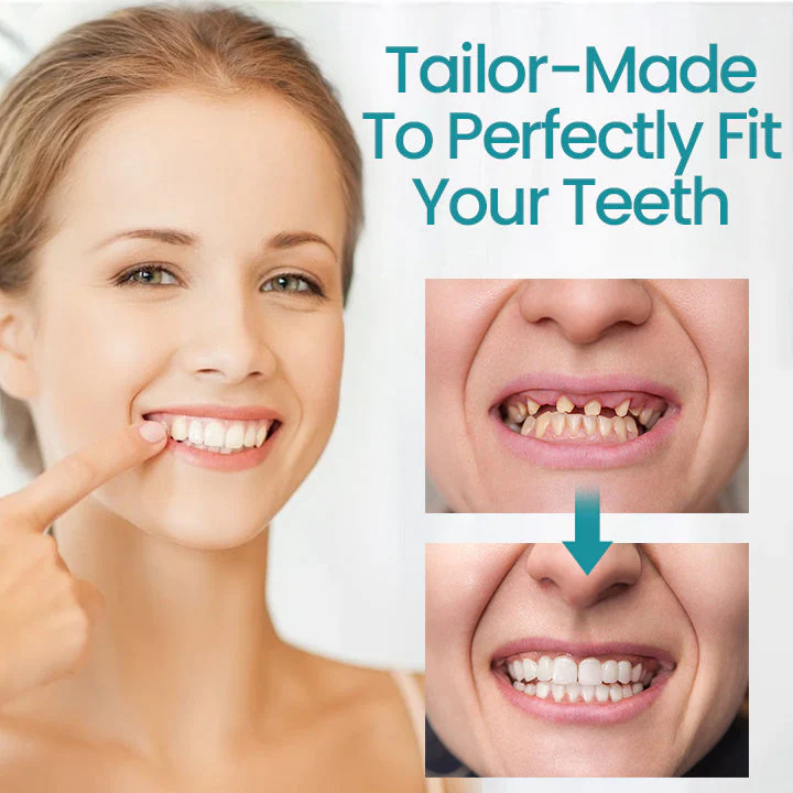 Ceoerty™ Adjustable Buckle Dentures