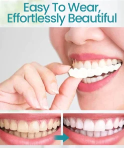 Ceoerty™ Adjustable Buckle Dentures