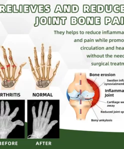Dobshow™ Pain and bone healing cream with Australian honey bee venom