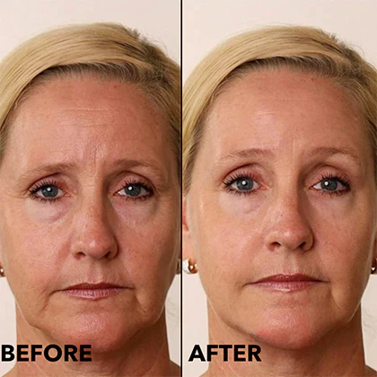 Fast Elevate Multi-Peptide Serum