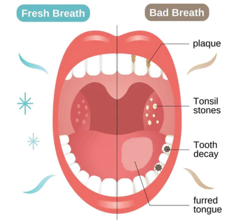 Fivfivgo™ 1% Alpha Hydroxy Acid TAmpoule Toothpaste 