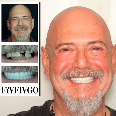Fivfivgo™ Adjustable Snap-On Dentures