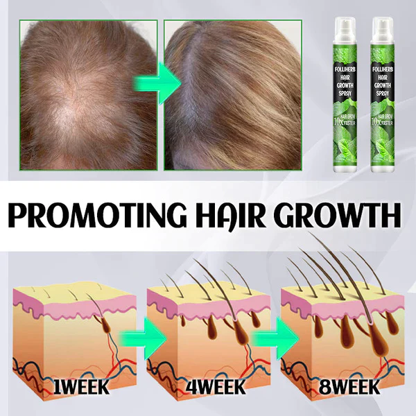 Fivfivgo™ FolliHerb Hair Growth Spray