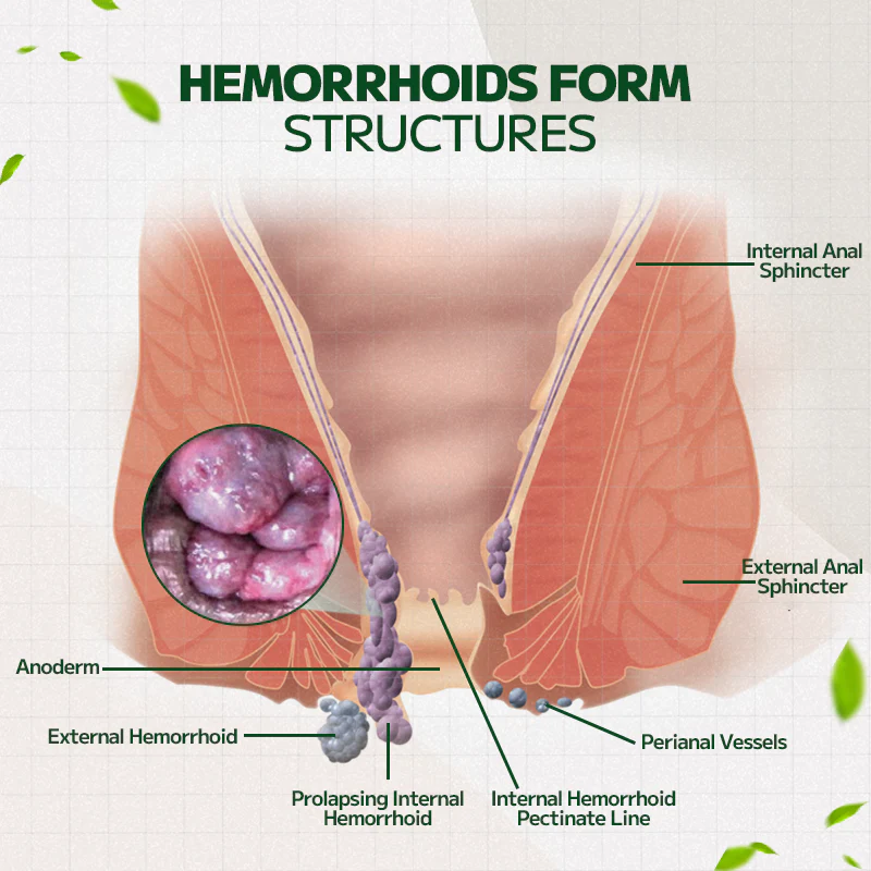 Fivfivgo™ Hemorrhoidal Ointment