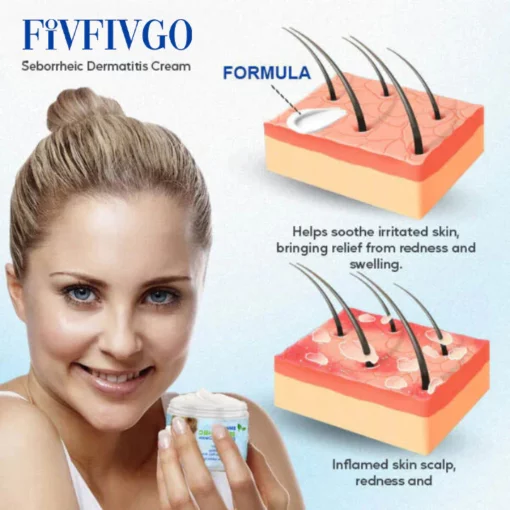 Fivfivgo™ Creme para Dermatite Seborreica