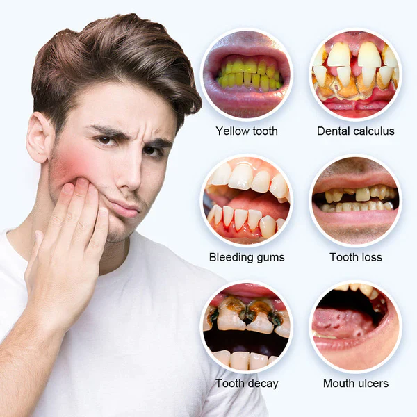Fivfivgo™ Tosken bleken Repair Regrowth Dental Gel