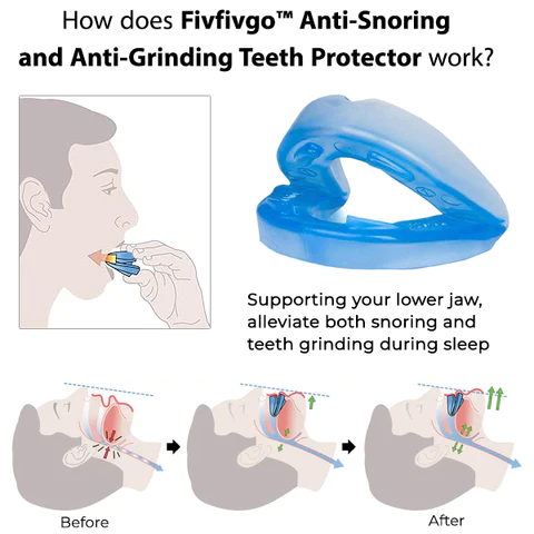 Fivfivgo™ Zahnschutz gegen Schnarchen und Knirschen 