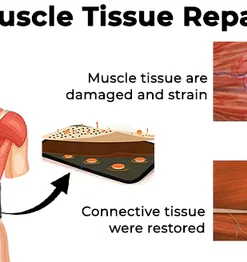 Fivfivgo™ Acupressure Back Relief Belt