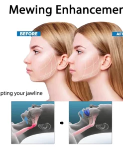 Fivfivgo™ Anti-Snoring and Anti-Grinding Teeth Protector