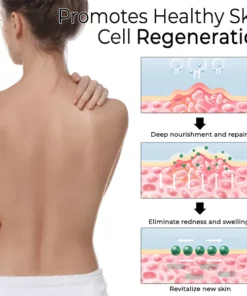 Fivfivgo™ Ätherisches Öl zur Psoriasis-Kur