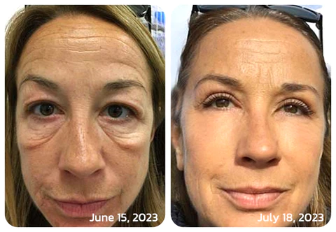 Fivfivgo™ CELYN Peptid-Straffungs-Augencreme