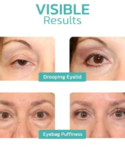 Oveallgo™ CELYN Peptide Taut Eye Cream