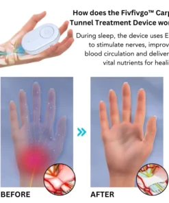 Fivfivgo™ Carpal Tunnel Treatment Device